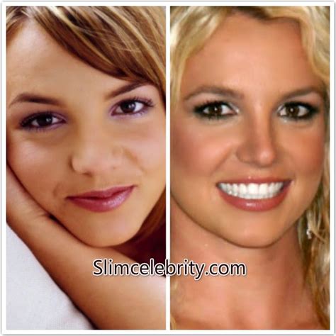 britney spears original nose|Britney Spears Nose Job 